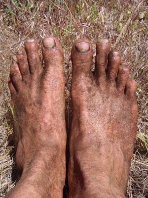 Dirty Feet.